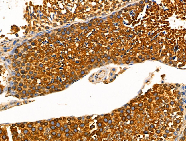 Phospho-KIF11 (Thr926) Antibody in Immunohistochemistry (Paraffin) (IHC (P))