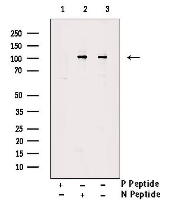 Phospho-VAV2 (Tyr142) Antibody in Western Blot (WB)