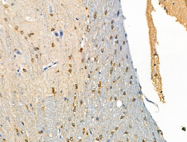 Phospho-FOXL2 (Ser238) Antibody in Immunohistochemistry (Paraffin) (IHC (P))