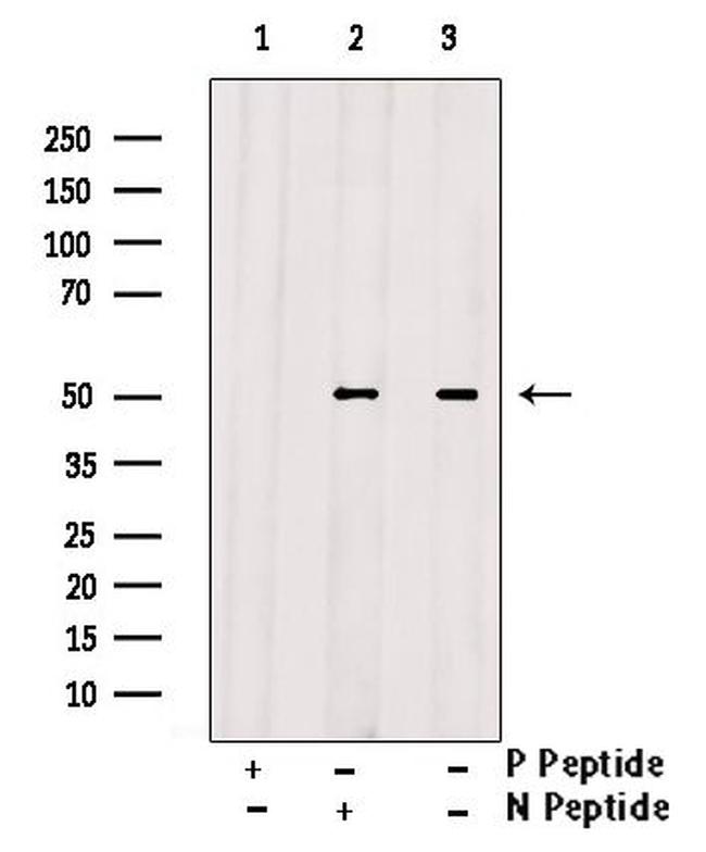 Phospho-FOXL2 (Ser238) Antibody in Western Blot (WB)