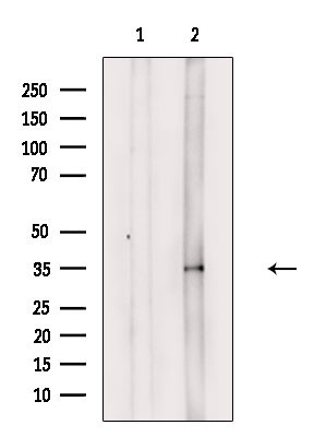 Phospho-PP2A alpha (Tyr307) Antibody in Western Blot (WB)