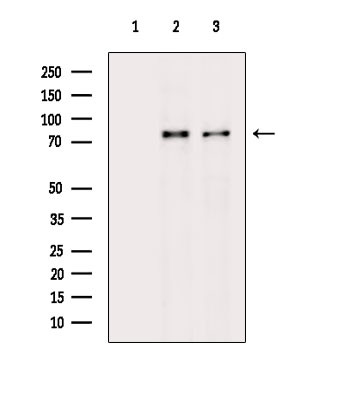 Phospho-PKC delta (Ser645) Antibody in Western Blot (WB)