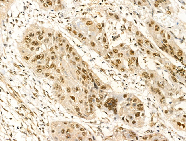 Phospho-FOXM1 (Ser35) Antibody in Immunohistochemistry (Paraffin) (IHC (P))