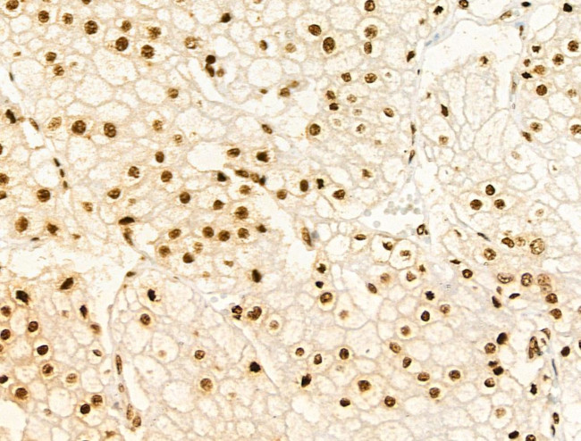 Phospho-FOXM1 (Ser35) Antibody in Immunohistochemistry (Paraffin) (IHC (P))