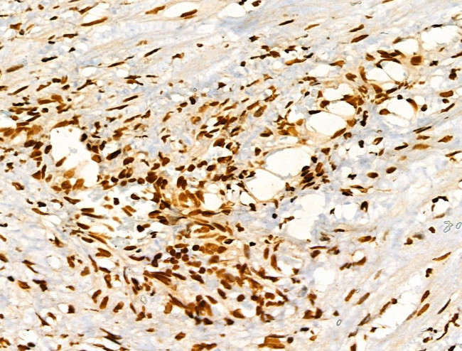 Phospho-FOXM1 (Ser35) Antibody in Immunohistochemistry (Paraffin) (IHC (P))