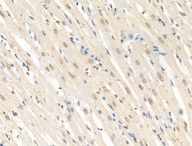 Phospho-FOXM1 (Ser35) Antibody in Immunohistochemistry (Paraffin) (IHC (P))