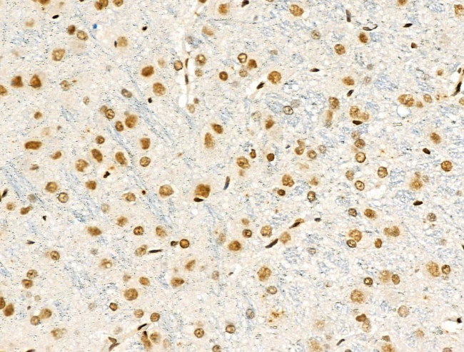 Phospho-FOXM1 (Ser35) Antibody in Immunohistochemistry (Paraffin) (IHC (P))