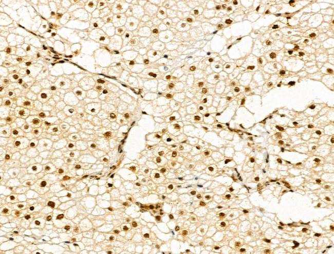 Phospho-PAK1/PAK2 (Thr423, Thr402) Antibody in Immunohistochemistry (Paraffin) (IHC (P))