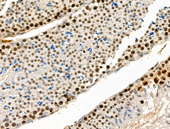 Phospho-PAK1/PAK2 (Thr423, Thr402) Antibody in Immunohistochemistry (Paraffin) (IHC (P))