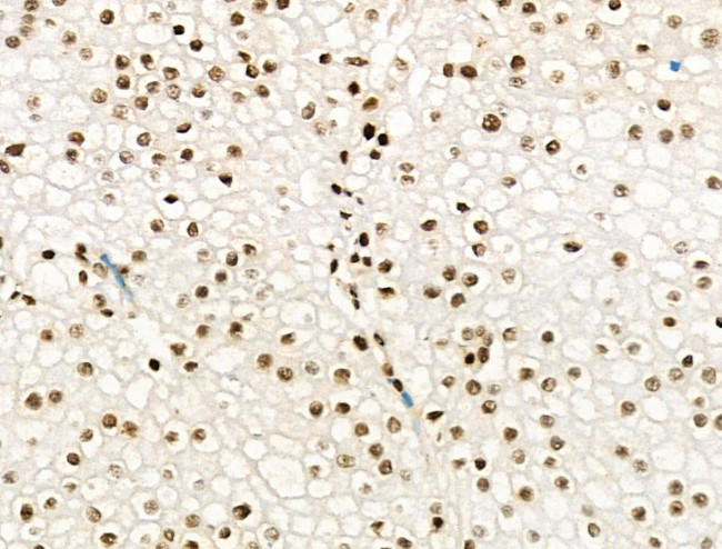 Phospho-PPIG (Ser376) Antibody in Immunohistochemistry (Paraffin) (IHC (P))