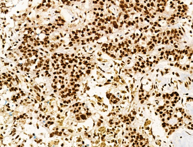 Phospho-PPIG (Ser376) Antibody in Immunohistochemistry (Paraffin) (IHC (P))