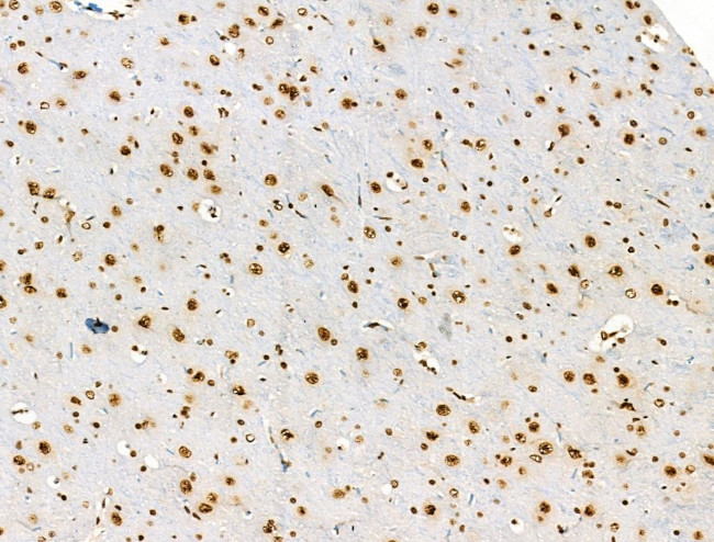 Phospho-PPIG (Ser376) Antibody in Immunohistochemistry (Paraffin) (IHC (P))