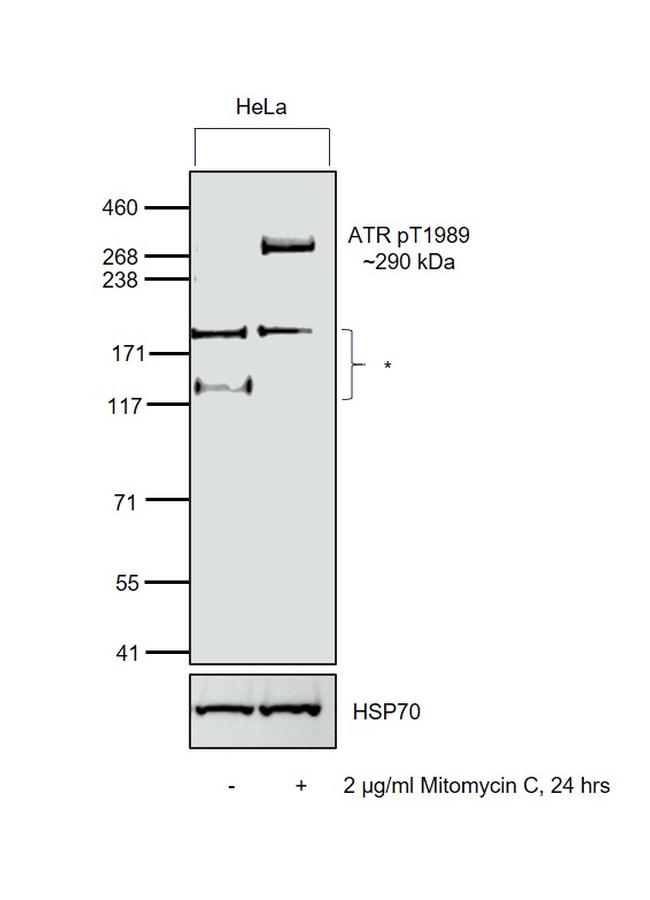 Phospho-ATR (Thr1989) Antibody in Western Blot (WB)