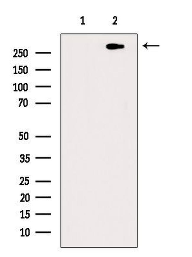 Phospho-ATR (Thr1989) Antibody in Western Blot (WB)