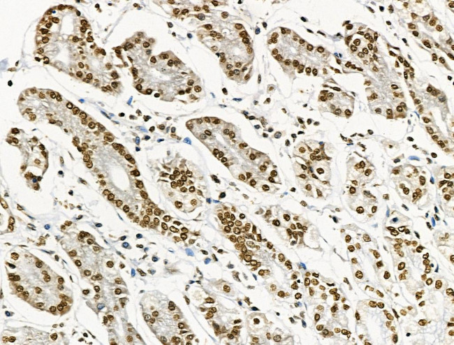 Phospho-BRK (Tyr447) Antibody in Immunohistochemistry (Paraffin) (IHC (P))