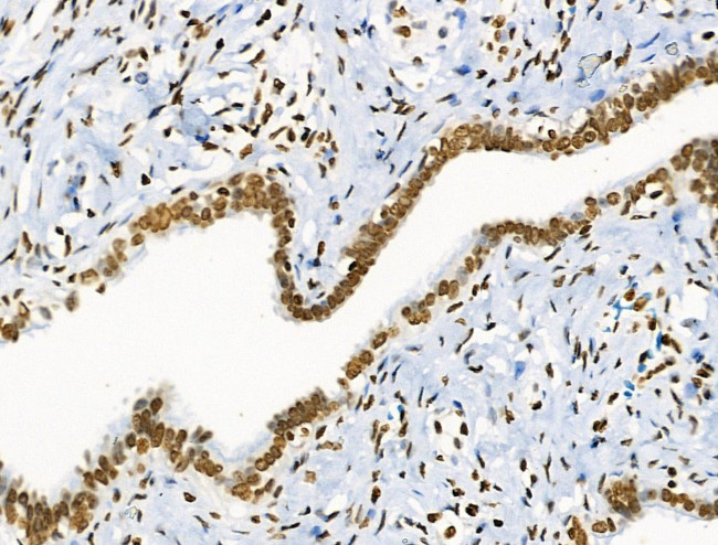 Phospho-BRK (Tyr447) Antibody in Immunohistochemistry (Paraffin) (IHC (P))