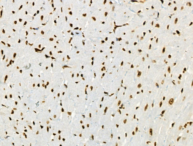 Phospho-BRK (Tyr447) Antibody in Immunohistochemistry (Paraffin) (IHC (P))