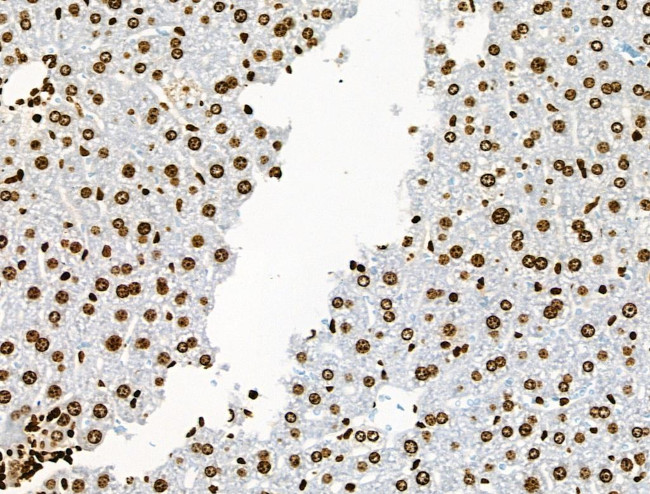 Phospho-BRK (Tyr447) Antibody in Immunohistochemistry (Paraffin) (IHC (P))