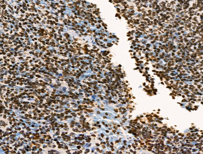 Phospho-BRK (Tyr447) Antibody in Immunohistochemistry (Paraffin) (IHC (P))