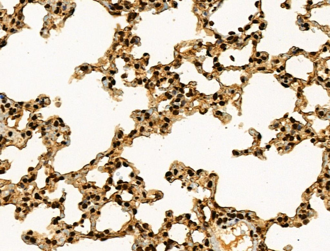 Phospho-BRK (Tyr447) Antibody in Immunohistochemistry (Paraffin) (IHC (P))