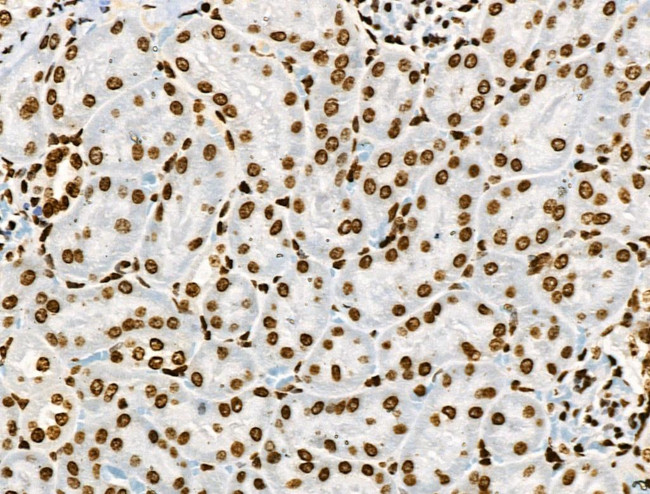 Phospho-BRK (Tyr447) Antibody in Immunohistochemistry (Paraffin) (IHC (P))