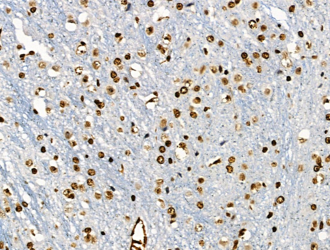 Phospho-BRK (Tyr447) Antibody in Immunohistochemistry (Paraffin) (IHC (P))