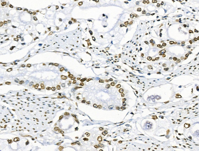 Phospho-BRK (Tyr447) Antibody in Immunohistochemistry (Paraffin) (IHC (P))