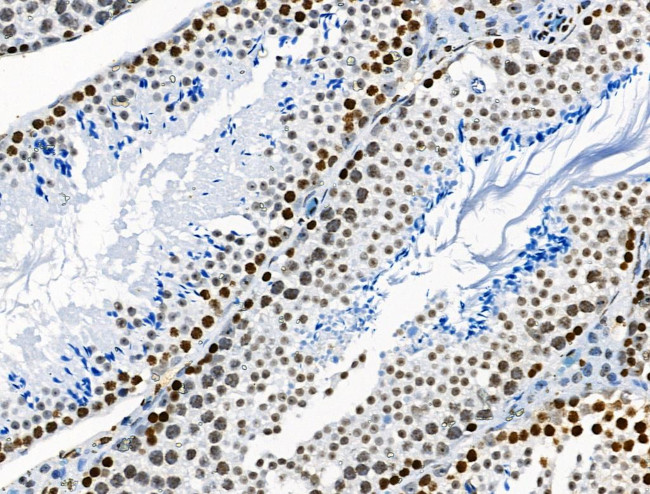 Phospho-BRK (Tyr447) Antibody in Immunohistochemistry (Paraffin) (IHC (P))