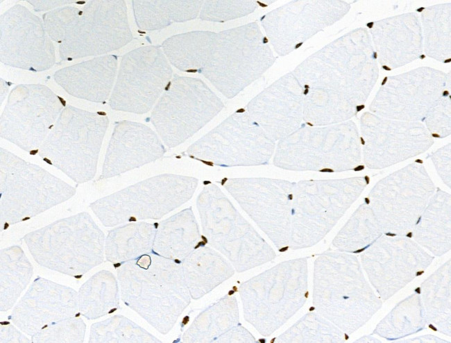 Phospho-BRK (Tyr447) Antibody in Immunohistochemistry (Paraffin) (IHC (P))