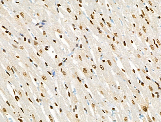 Phospho-BRK (Tyr447) Antibody in Immunohistochemistry (Paraffin) (IHC (P))