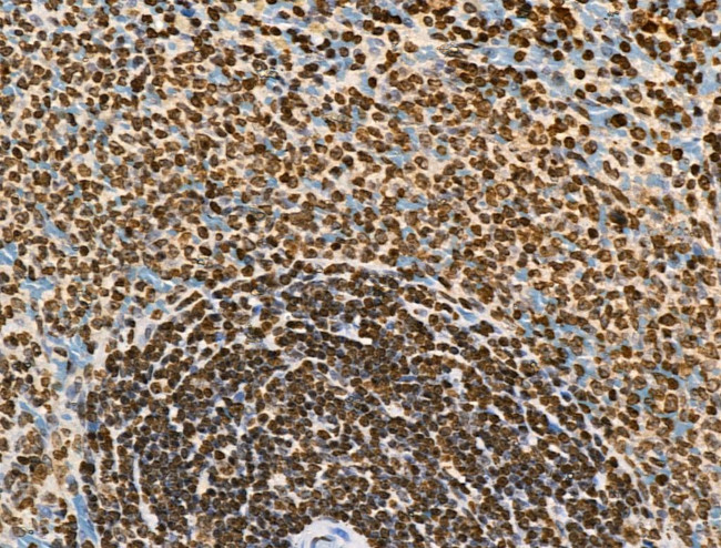 Phospho-BRK (Tyr447) Antibody in Immunohistochemistry (Paraffin) (IHC (P))