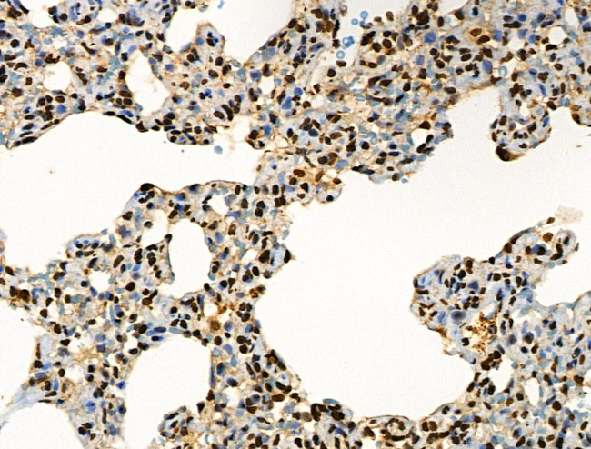 Phospho-BRK (Tyr447) Antibody in Immunohistochemistry (Paraffin) (IHC (P))