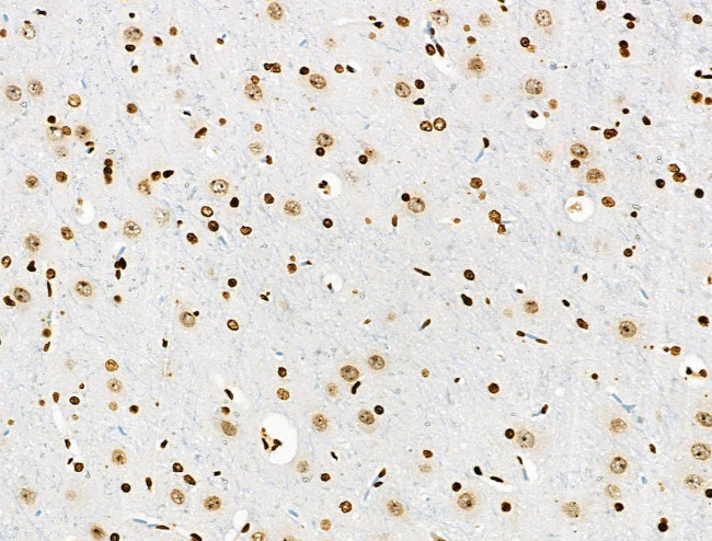 Phospho-BRK (Tyr447) Antibody in Immunohistochemistry (Paraffin) (IHC (P))