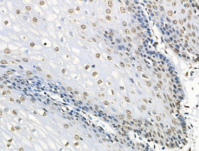 Phospho-BRK (Tyr447) Antibody in Immunohistochemistry (Paraffin) (IHC (P))