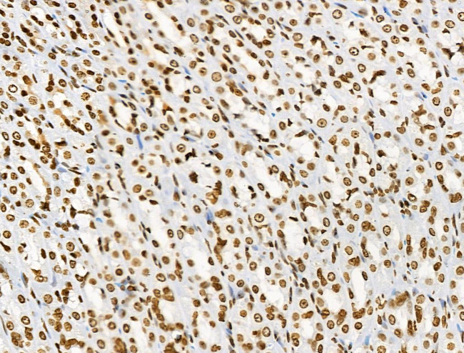 Phospho-BRK (Tyr447) Antibody in Immunohistochemistry (Paraffin) (IHC (P))