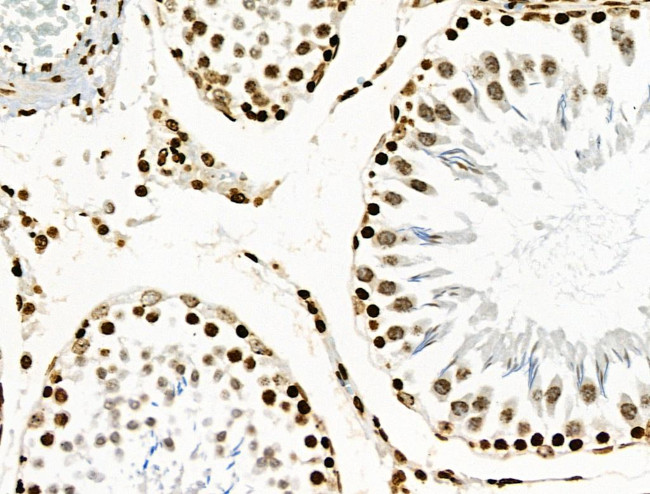 Phospho-BRK (Tyr447) Antibody in Immunohistochemistry (Paraffin) (IHC (P))