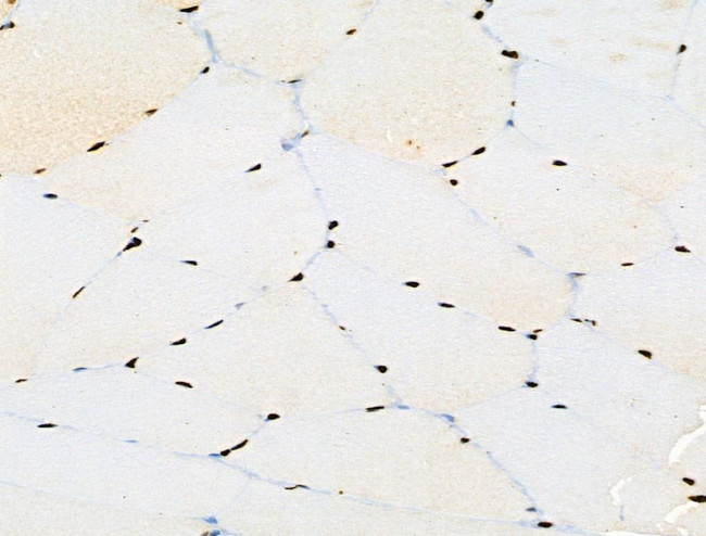 Phospho-BRK (Tyr447) Antibody in Immunohistochemistry (Paraffin) (IHC (P))