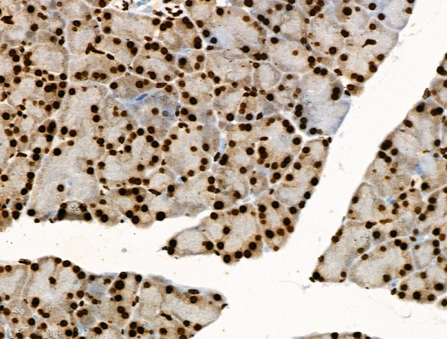 Phospho-BRK (Tyr447) Antibody in Immunohistochemistry (Paraffin) (IHC (P))