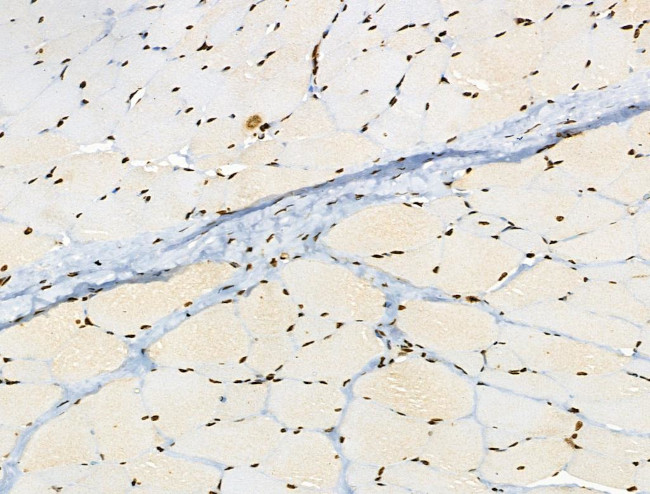 Phospho-BRK (Tyr447) Antibody in Immunohistochemistry (Paraffin) (IHC (P))