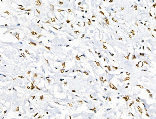 Phospho-BRK (Tyr447) Antibody in Immunohistochemistry (Paraffin) (IHC (P))