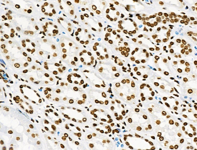 Phospho-BRK (Tyr447) Antibody in Immunohistochemistry (Paraffin) (IHC (P))