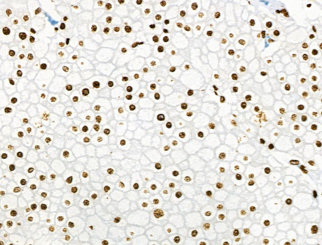 Phospho-BRK (Tyr447) Antibody in Immunohistochemistry (Paraffin) (IHC (P))