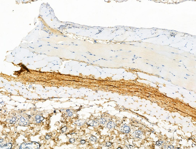 Phospho-RAPGEF1 (Thr1071) Antibody in Immunohistochemistry (Paraffin) (IHC (P))