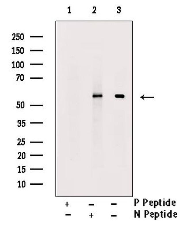 Phospho-RUNX2 (Ser340) Antibody in Western Blot (WB)