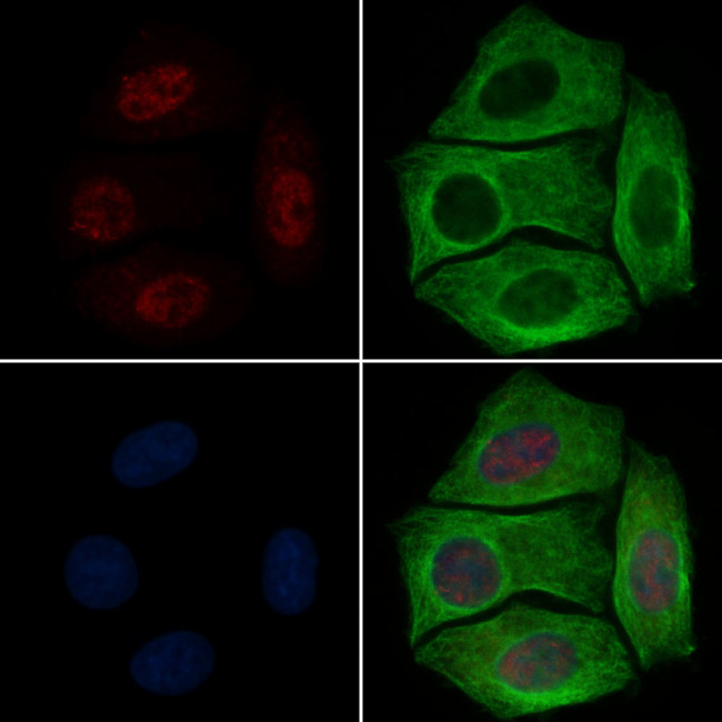 Phospho-RUNX2 (Ser340) Antibody in Immunocytochemistry (ICC/IF)