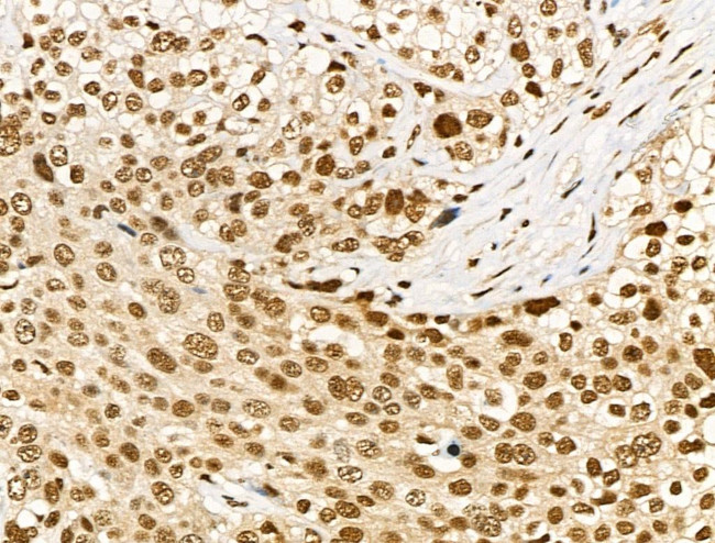 Phospho-RUNX2 (Ser340) Antibody in Immunohistochemistry (Paraffin) (IHC (P))