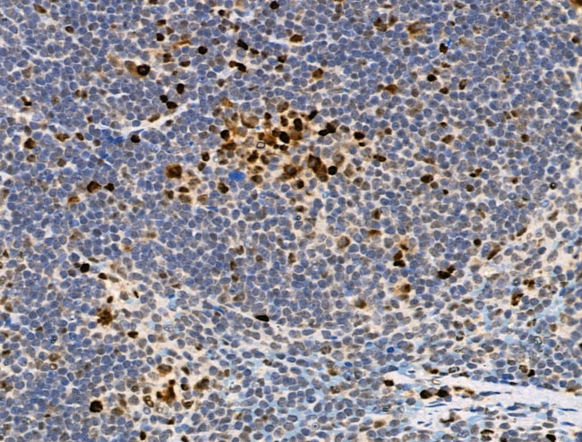 Phospho-RUNX2 (Ser340) Antibody in Immunohistochemistry (Paraffin) (IHC (P))