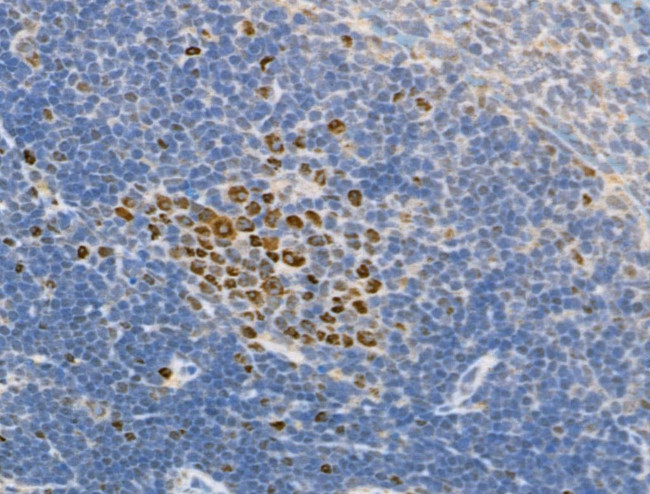 Phospho-RUNX2 (Ser340) Antibody in Immunohistochemistry (Paraffin) (IHC (P))