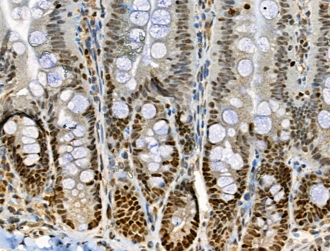 Phospho-RUNX2 (Ser340) Antibody in Immunohistochemistry (Paraffin) (IHC (P))