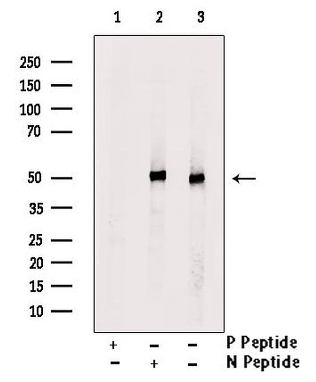 Phospho-IRF4 (Tyr122, Tyr125) Antibody in Western Blot (WB)